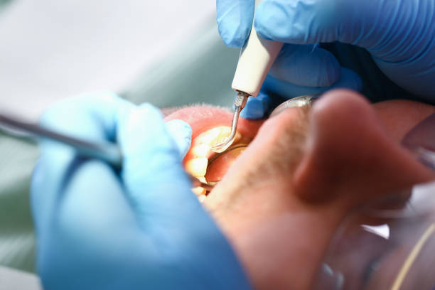 Best Emergency Dental Extractions in Mcewen, TN