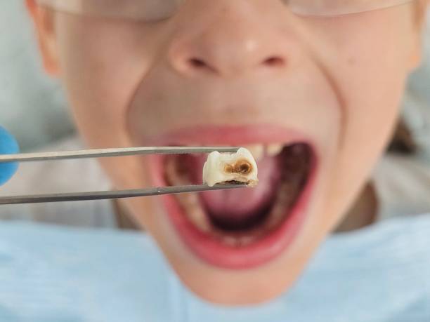 Best 24-Hour Emergency Dentist in Mcewen, TN